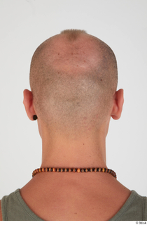 Photos Dylan Parker bald head 0004.jpg
